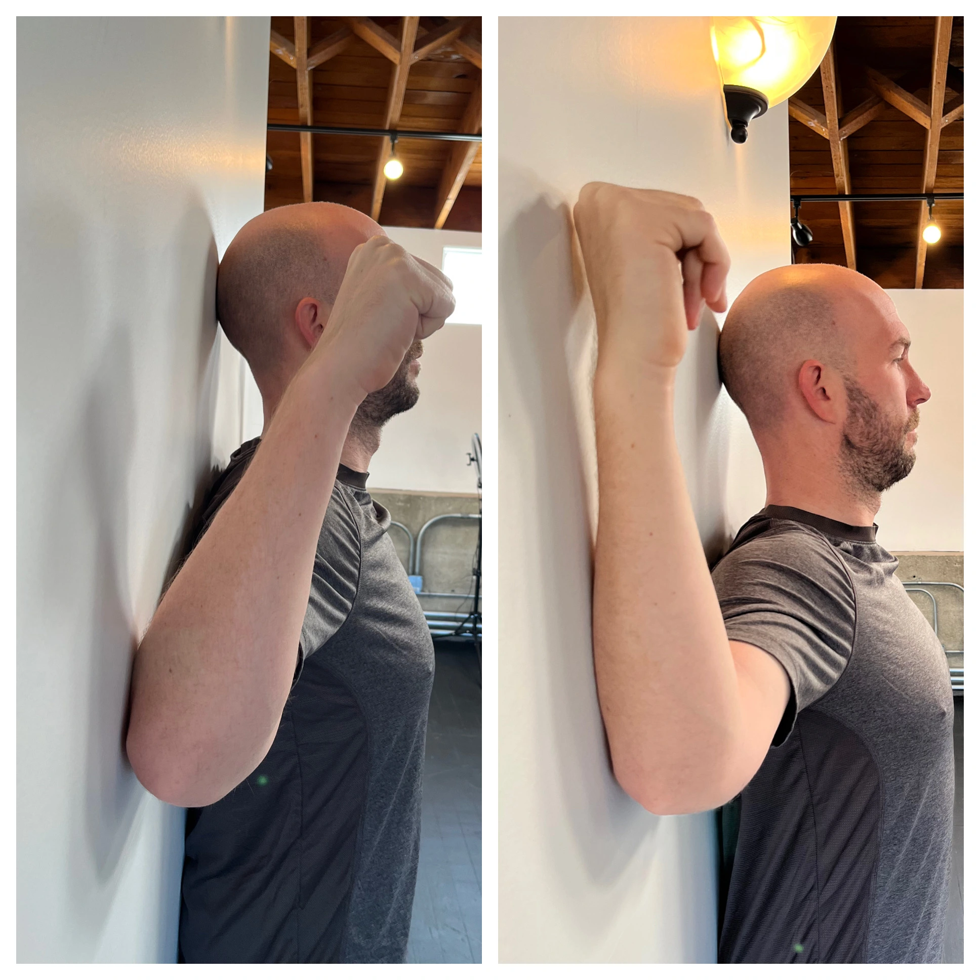 Dan Hahn shoulder mobility B&A